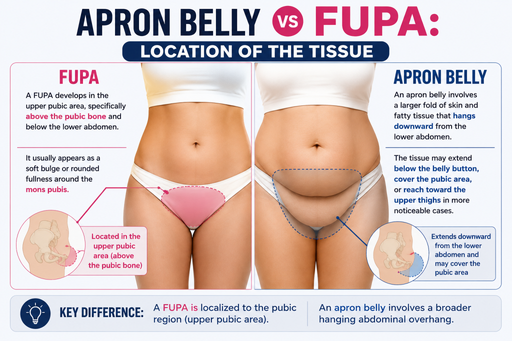 Apron Belly vs FUPA Location