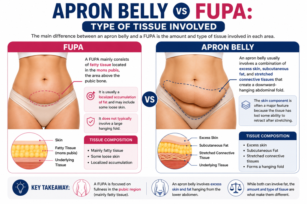 Apron Belly vs FUPA Type of Tissue Involved